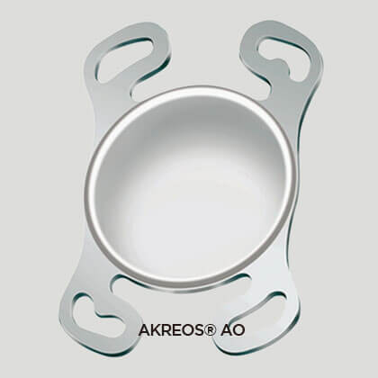 일반 백내장 수술