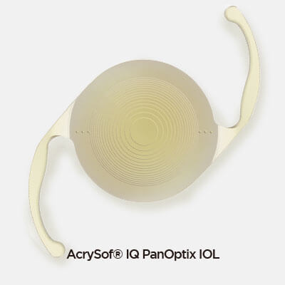 백내장 노안 난시 수술