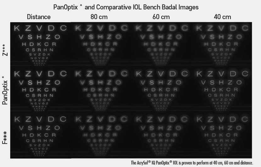 팬옵틱스 삽입술
