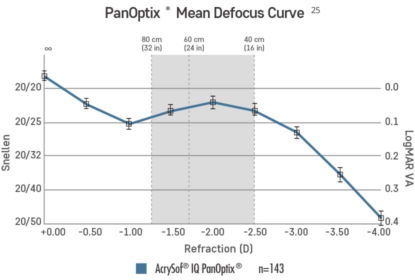 팬옵틱스 삽입술