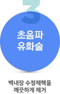 백내장수술과정3 백내장수술과정