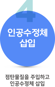 백내장수술과정4 백내장수술과정