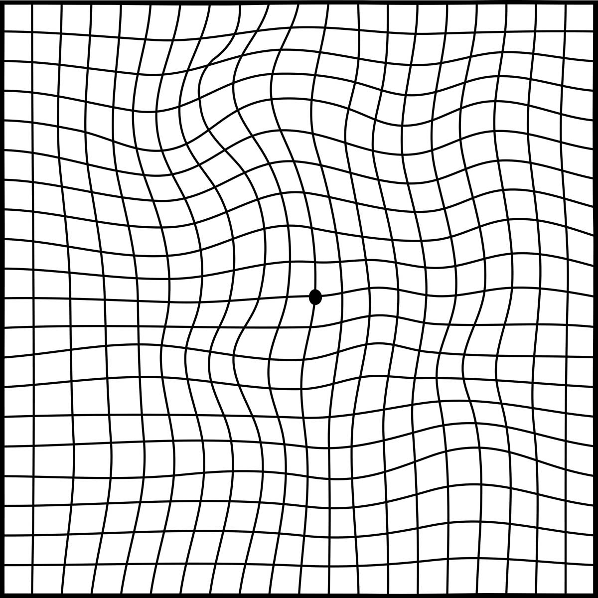 amsler_grid-01 황반변성 자가진단