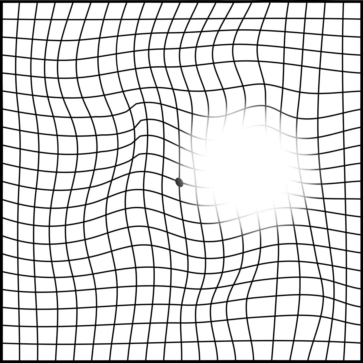 amsler_grid-02 황반변성 자가진단