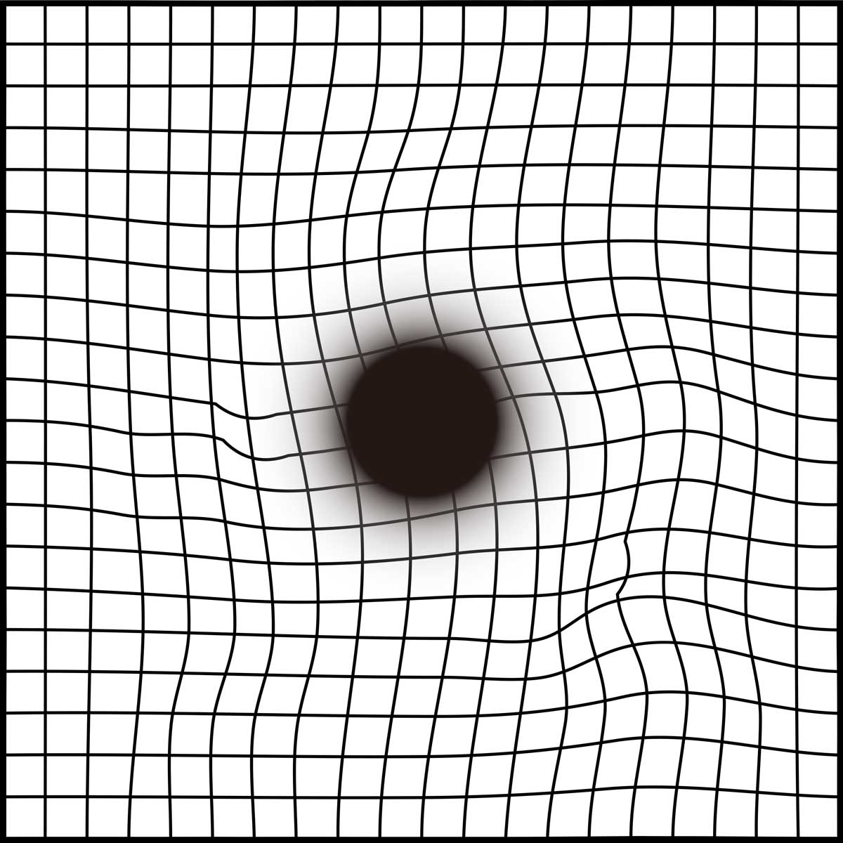 amsler_grid-03 황반변성 자가진단