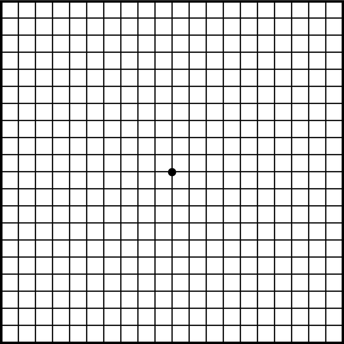 amsler_grid 황반변성 자가진단
