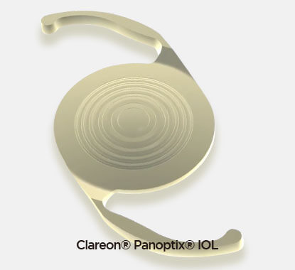 클라레온 삽입술